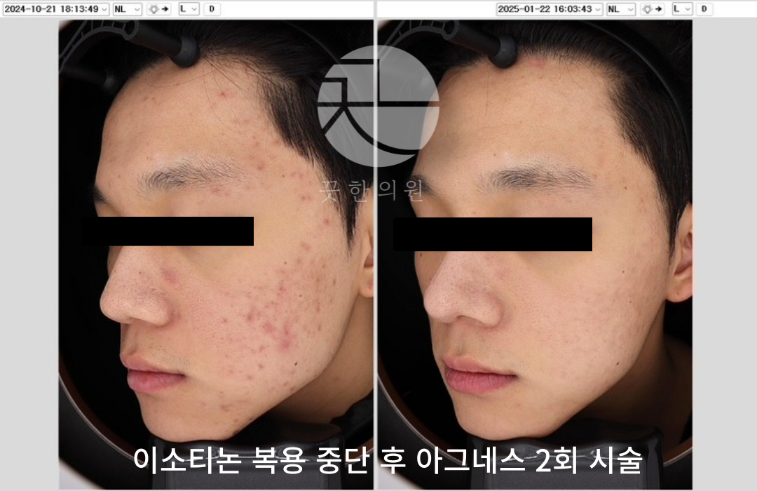랜딩이미지