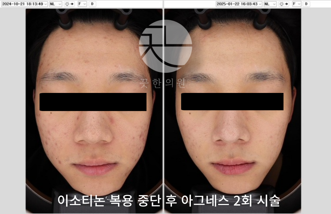 랜딩이미지