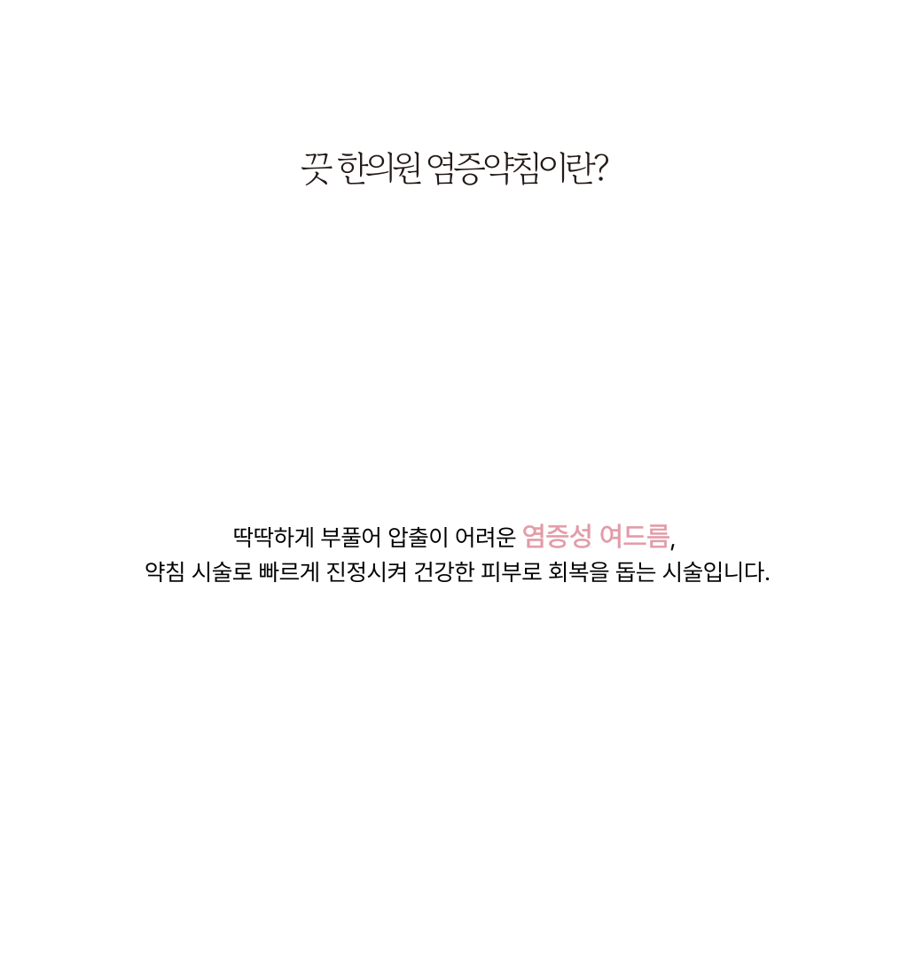 랜딩이미지