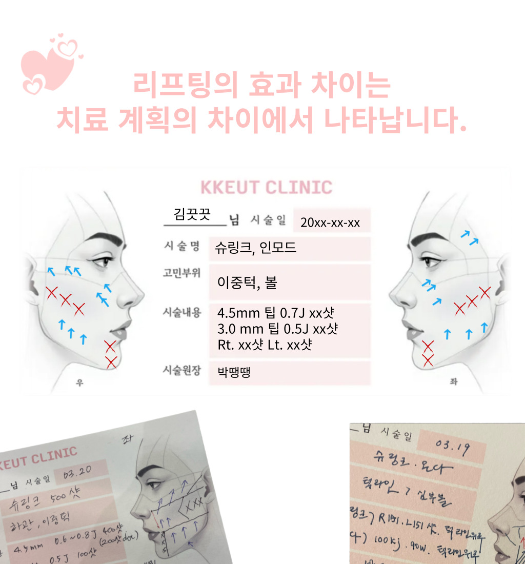 랜딩이미지