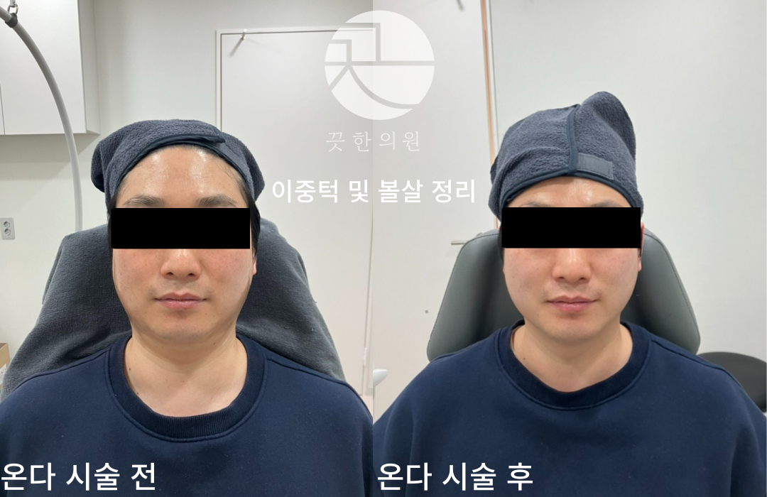랜딩이미지