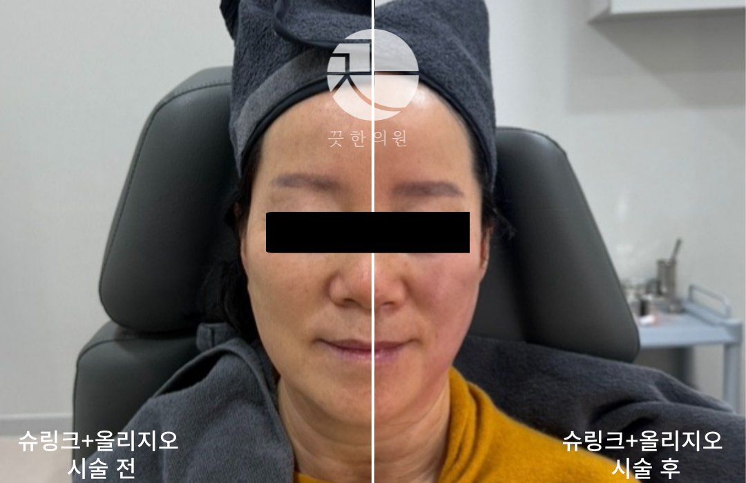 랜딩이미지