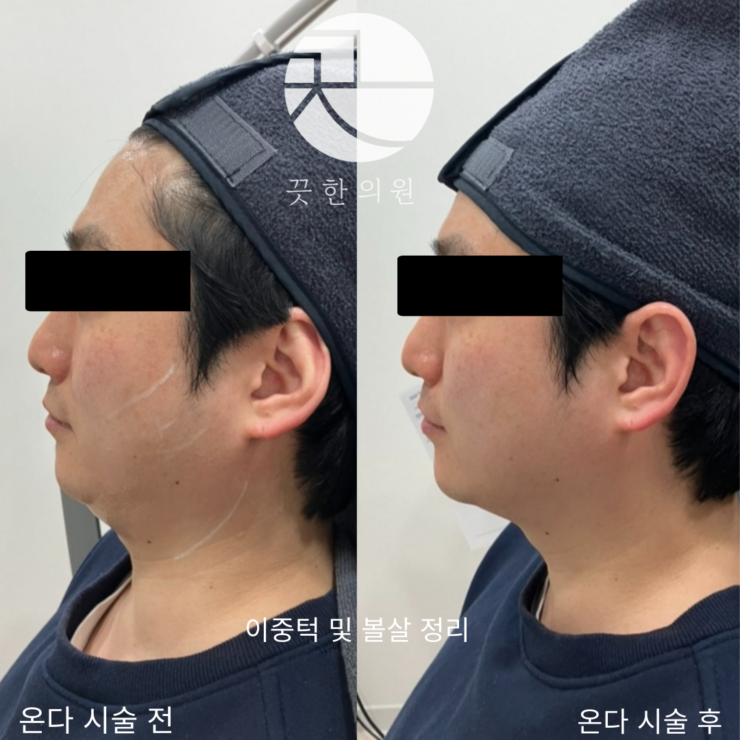 랜딩이미지