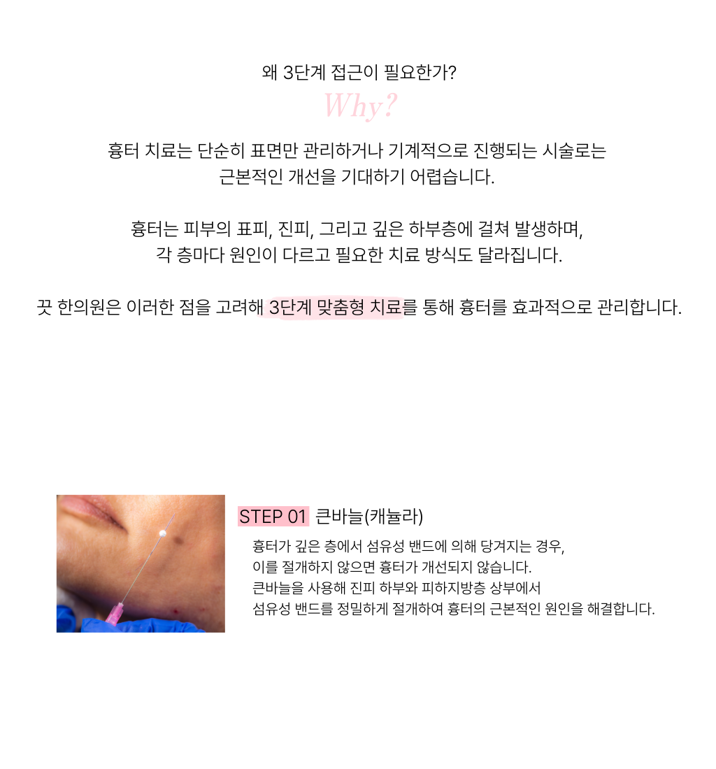 랜딩이미지