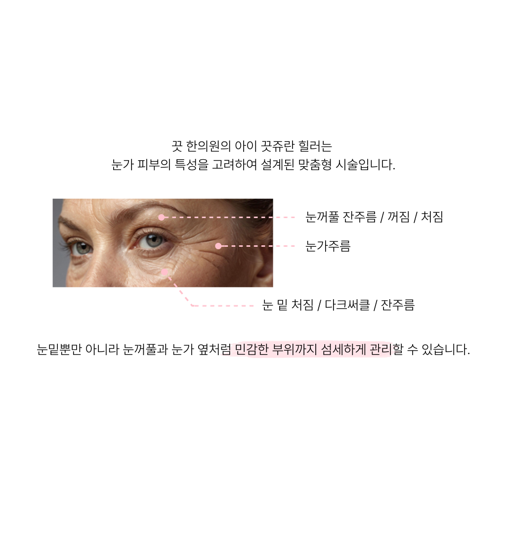 랜딩이미지