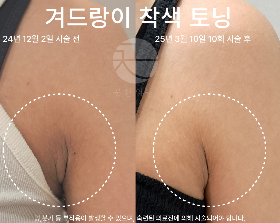 랜딩이미지