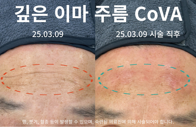랜딩이미지