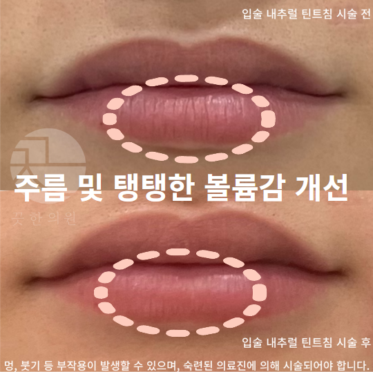 랜딩이미지