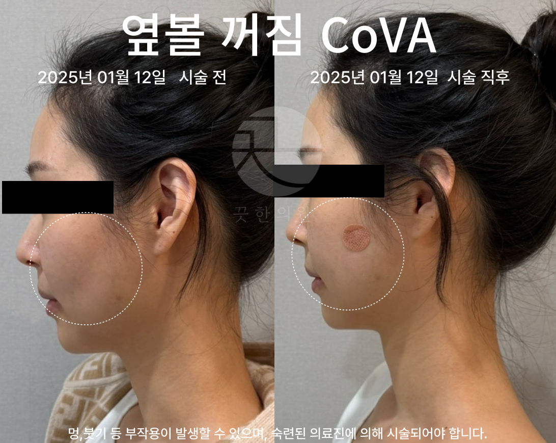 랜딩이미지