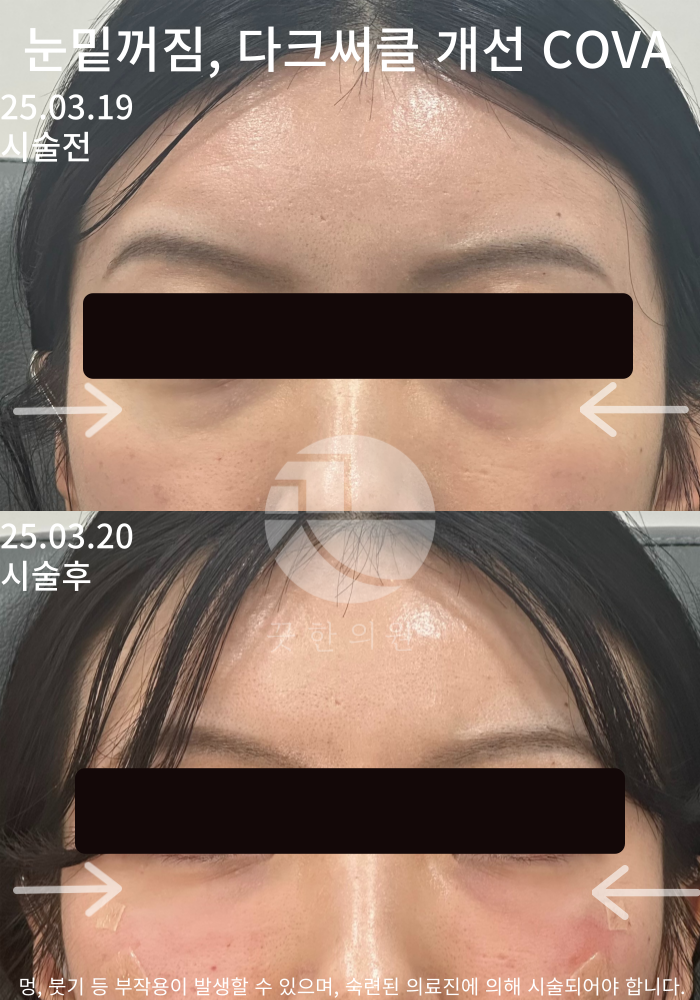 랜딩이미지