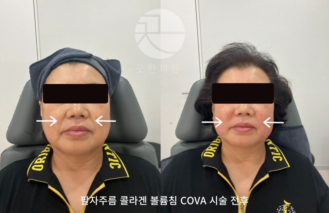 랜딩이미지