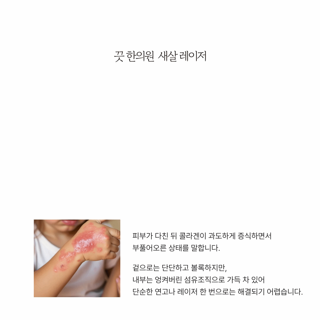 랜딩이미지
