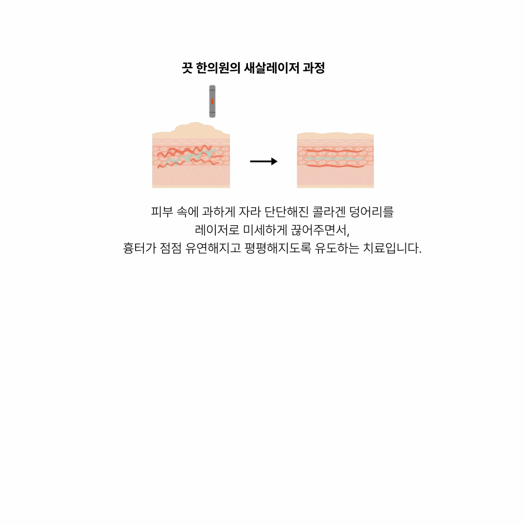 랜딩이미지