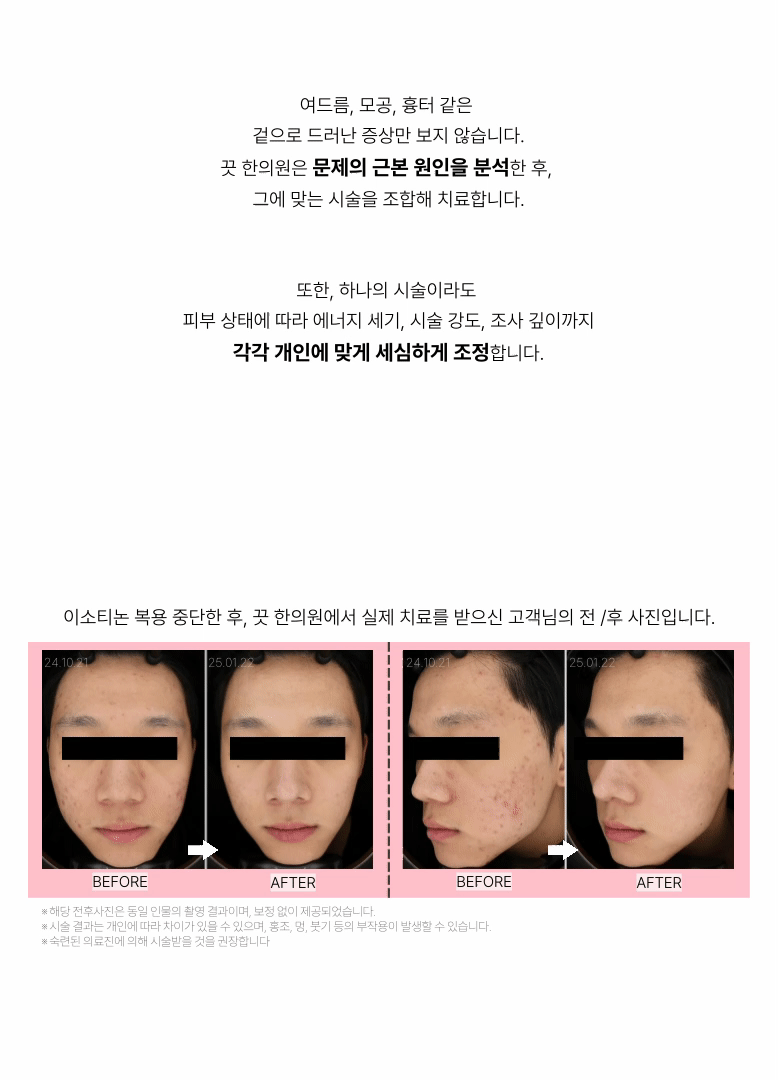랜딩이미지