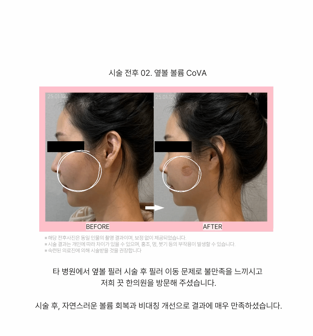 랜딩이미지