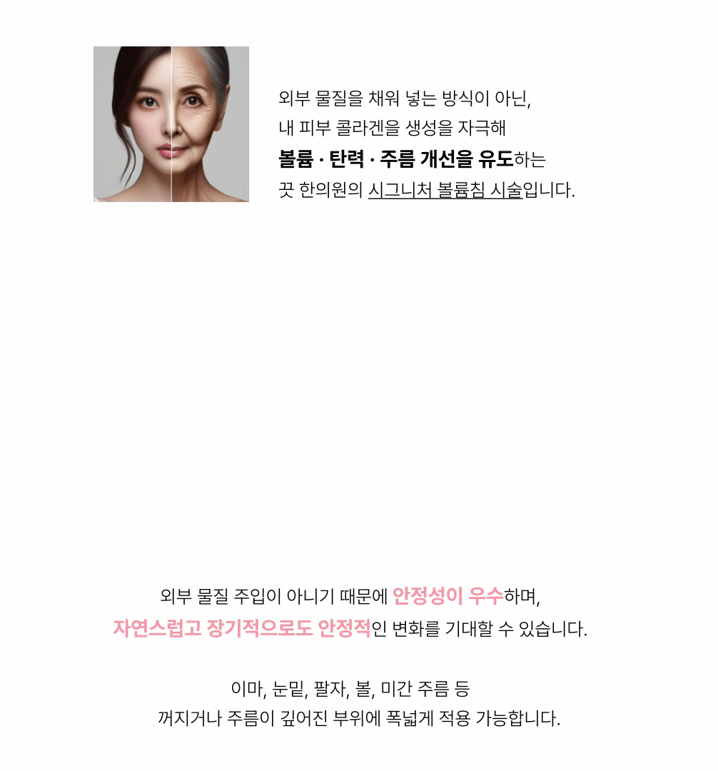 랜딩이미지