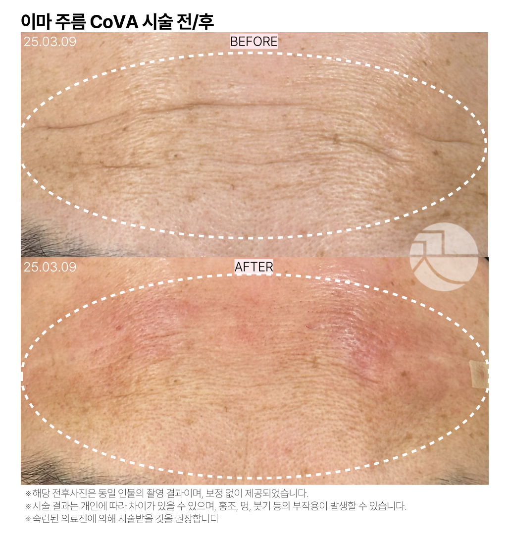 랜딩이미지