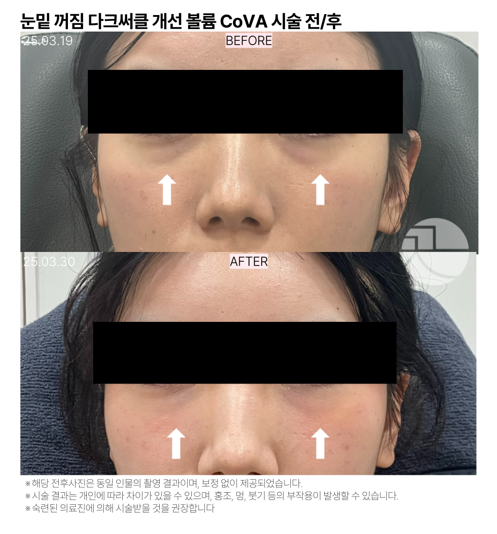랜딩이미지