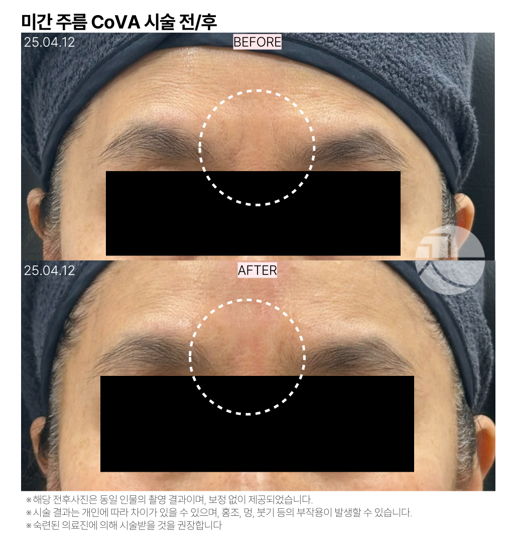 랜딩이미지