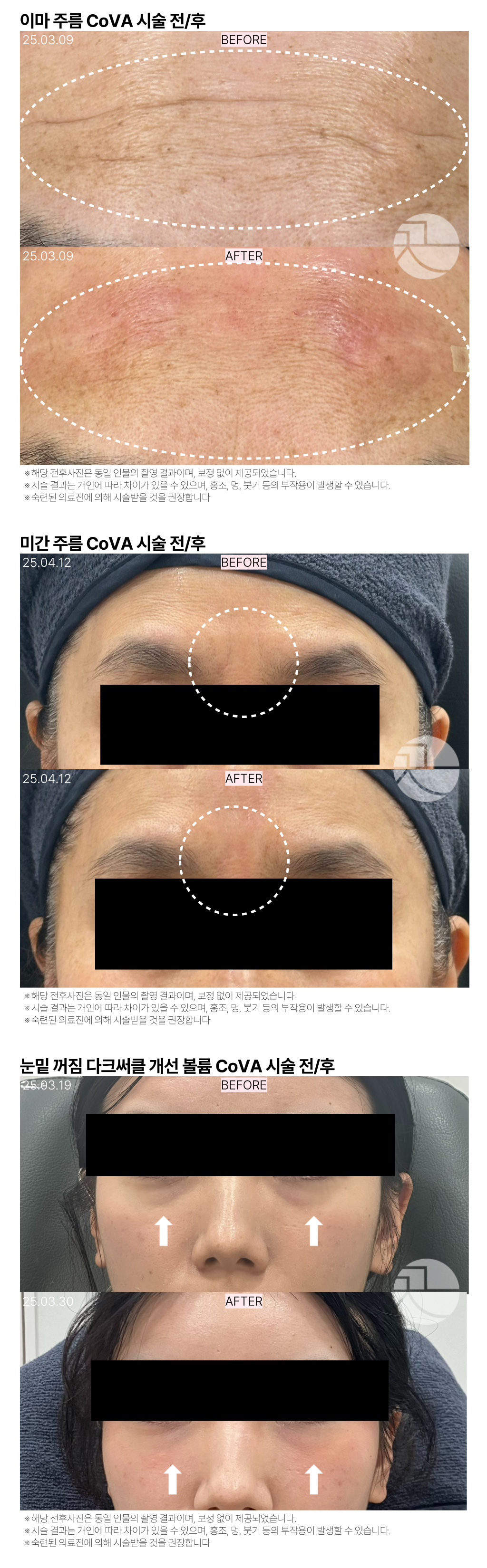 랜딩이미지